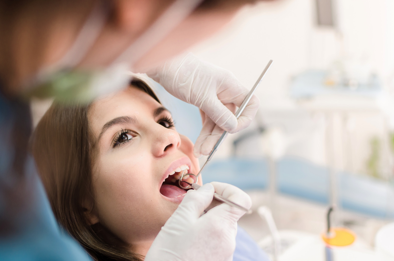 Qual a melhor opção para clarear os dentes?